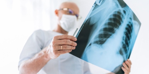 Doctor wearing a white mask looking at a lung x-ray.