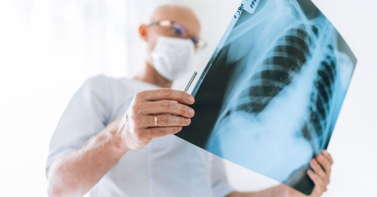 Doctor wearing a white mask looking at a lung x-ray.